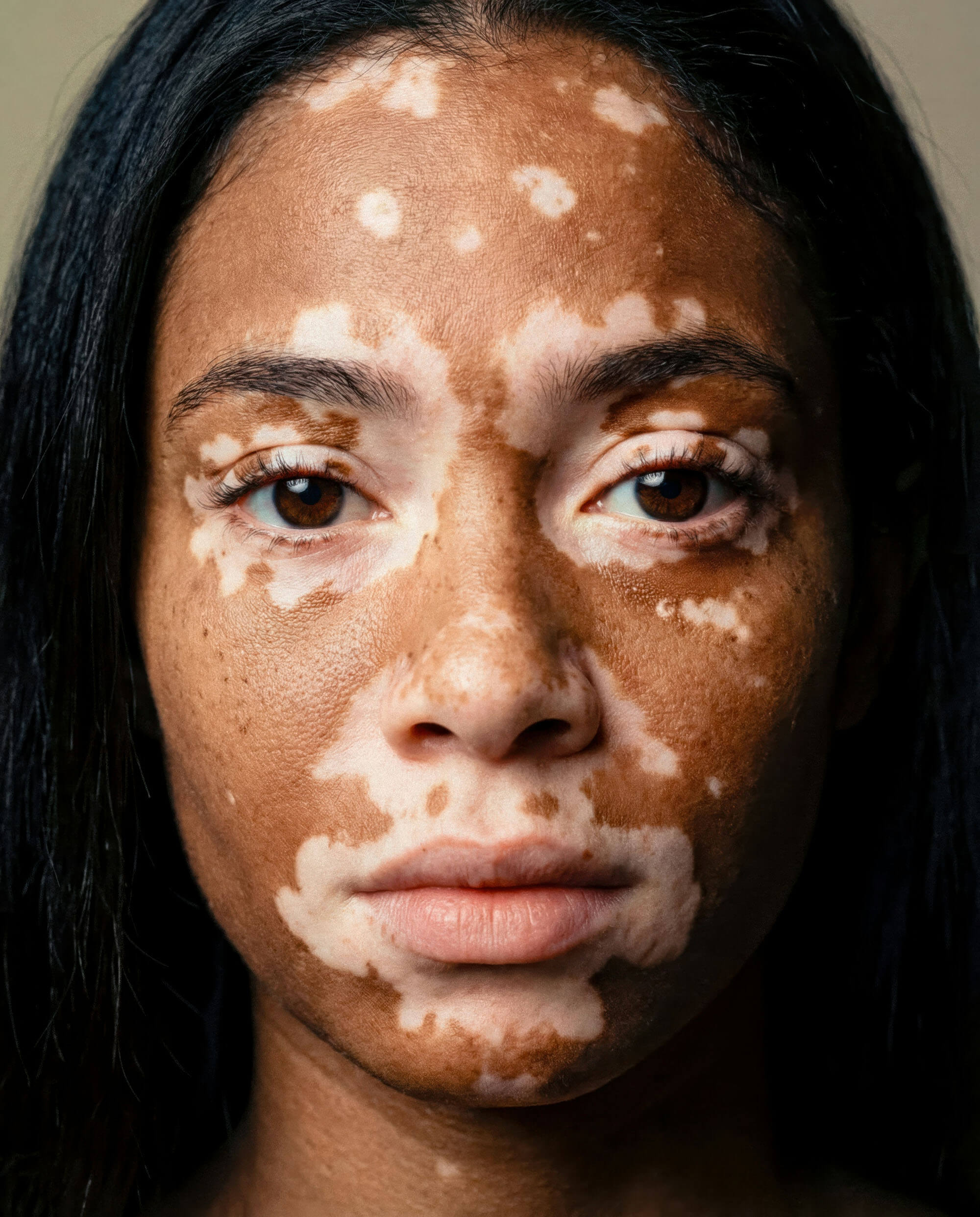 Before — Spot Removal